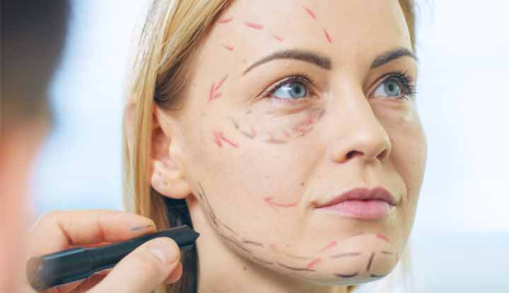 face lifting treatment